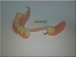 proteza częściowa dolna
