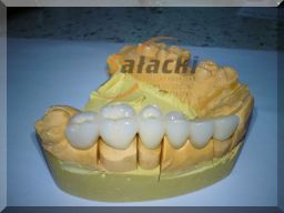Most Porcelanowy częściowy